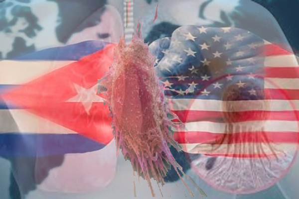 avanza la vacuna cubana contra el cáncer el pulmón en estados unidos