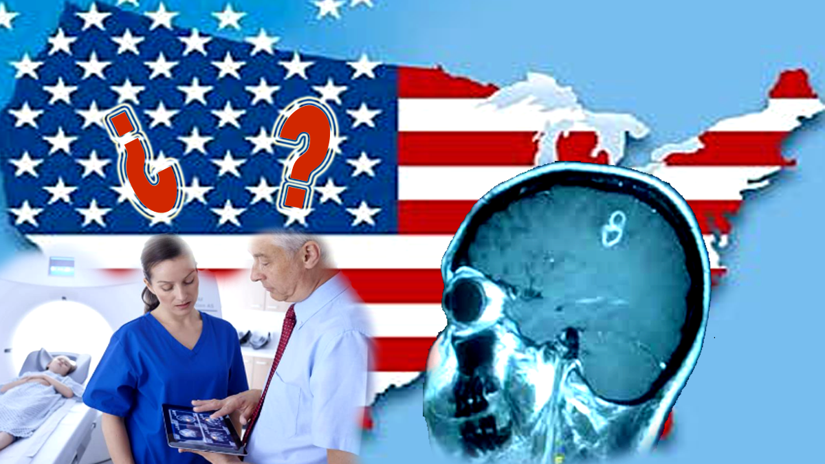 Por qué hay un aumento de abscesos cerebrales en EE.UU.