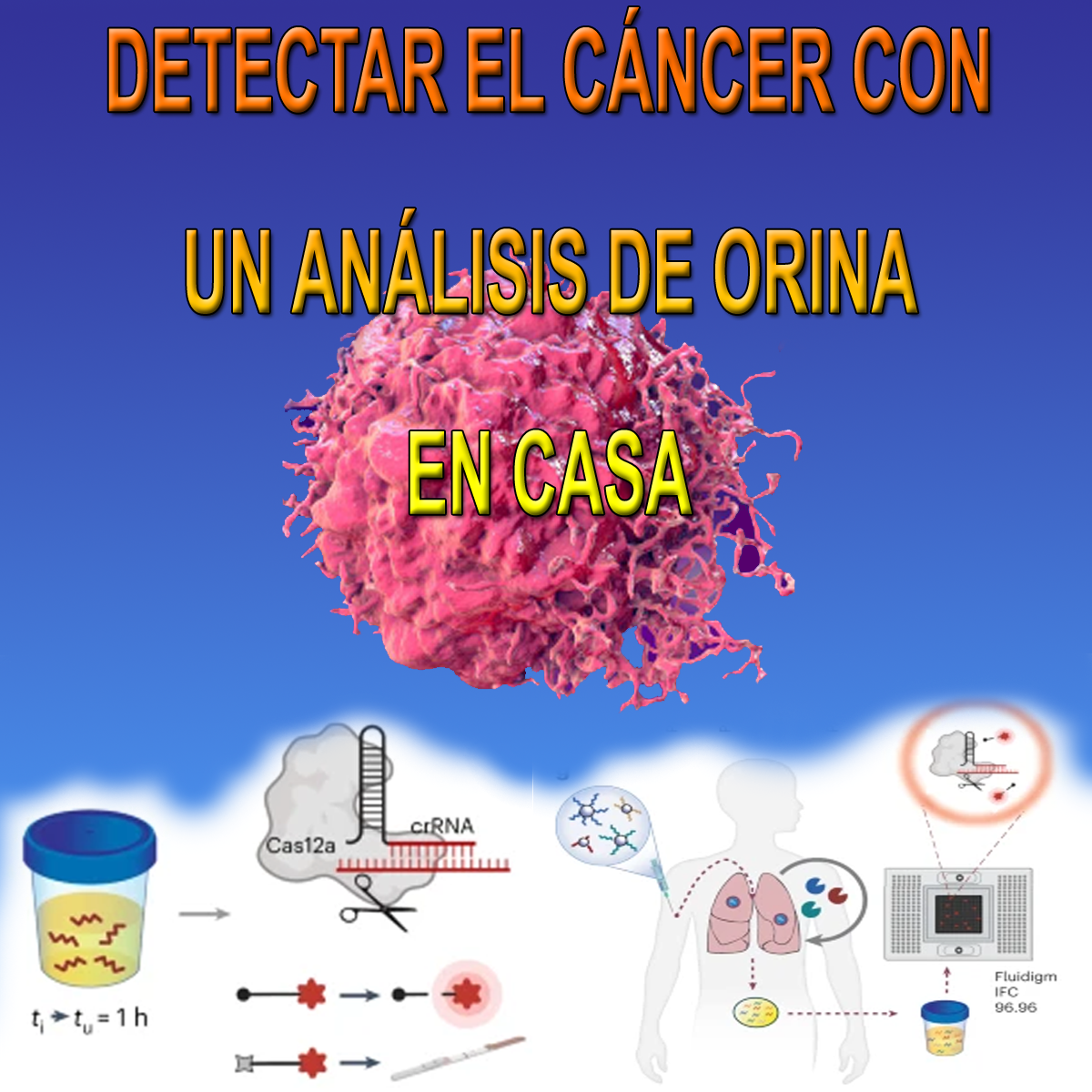 detectar el cáncer en casa con un análisis de orina